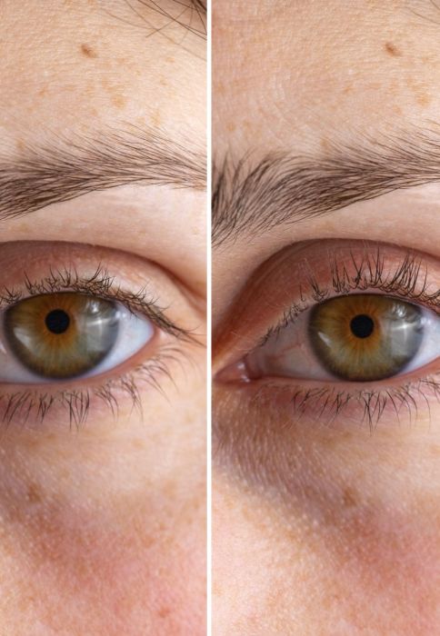 izgled trepavica prije i nakon upotrebe STYLPRO Heated Lash Curler uvijača za trepavice